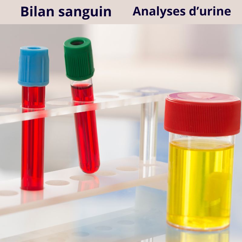 prises de sang et analyses d'urines