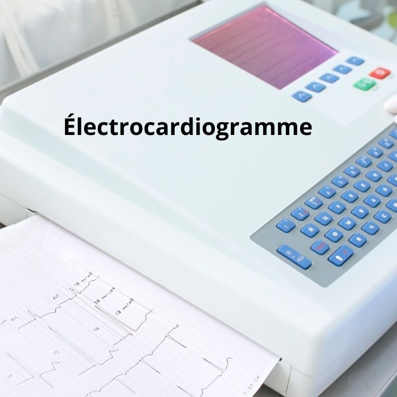 electrocardiogramme