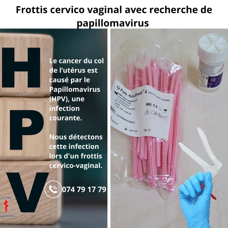 dépistage du cancer du col de l'utérus par un frottis cervico vaginal